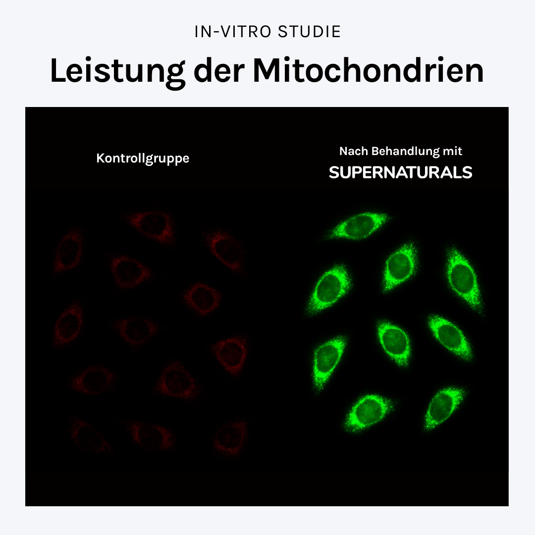 Fluoreszenzbasierte Visualisierung des mitochondrialen Leistungspotentials (ΔΨm) in menschlichen Zellen nach Behandlung mit SUPERNATURALS. Die Abbildung zeigt eine signifikante Zunahme grüner JC-1-Aggregate und damit ein stark erhöhtes Leistungspotential.